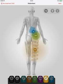 Distortion notes (front)